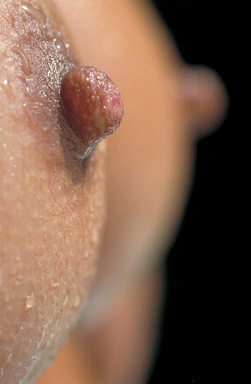 Erotic photo #567104